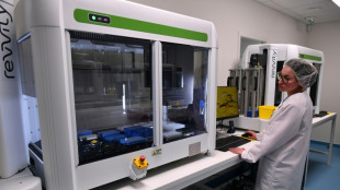 Endométriose: le pari contesté de l'Endotest, choyé par l'Etat