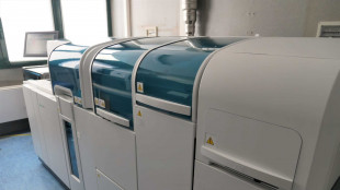 Citt&agrave; salute di Torino, automatizzata spettrometria di massa