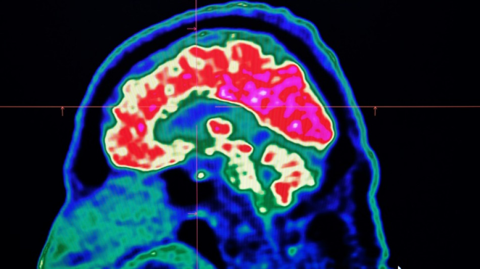 "D&eacute;coder" les pens&eacute;es par l'imagerie c&eacute;r&eacute;brale et l'intelligence artificielle