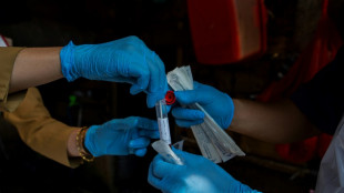 Premier cas humain de grippe aviaire de type H5N2 d&eacute;tect&eacute; au Mexique, selon l'OMS