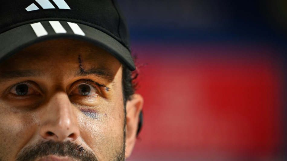 L1: apr&egrave;s le caillassage, retour au jeu pour Lyon en qu&ecirc;te de victoire