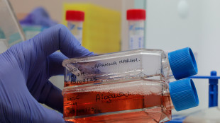 Ricerca in Italia, 'preoccupazione per lo spostamento di fondi'